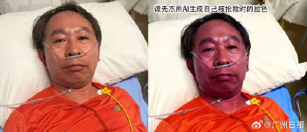 协和专家吃头孢过敏进抢救室