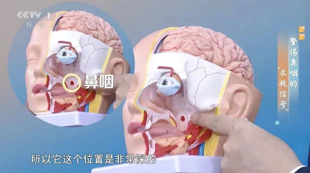 警惕！晨起后有这种现象，可能是癌症信号