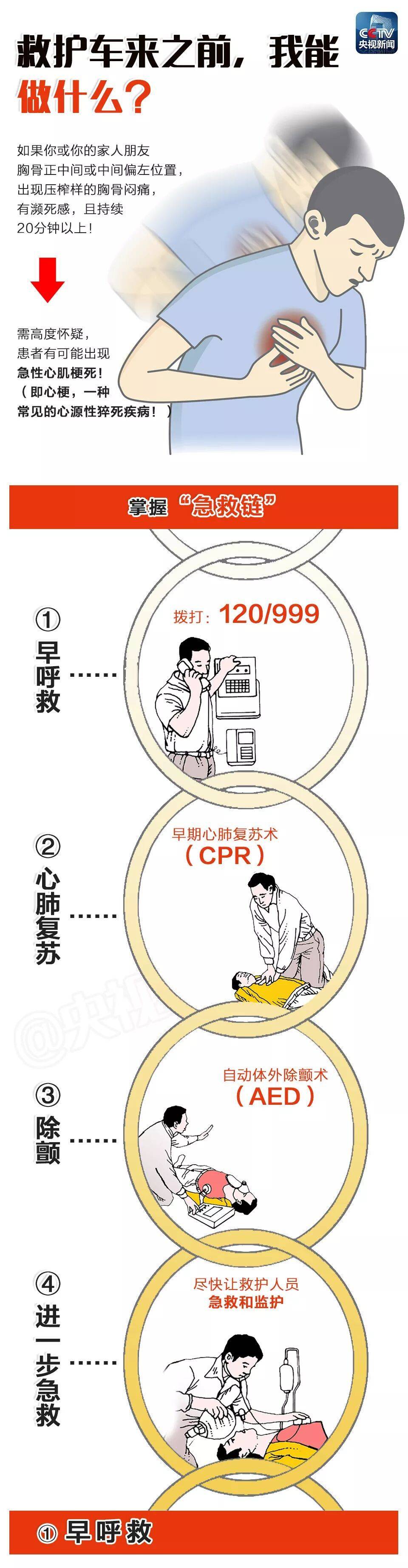 有濒死感，且持续20分钟以上！出现“心源性猝死”，请马上这样做