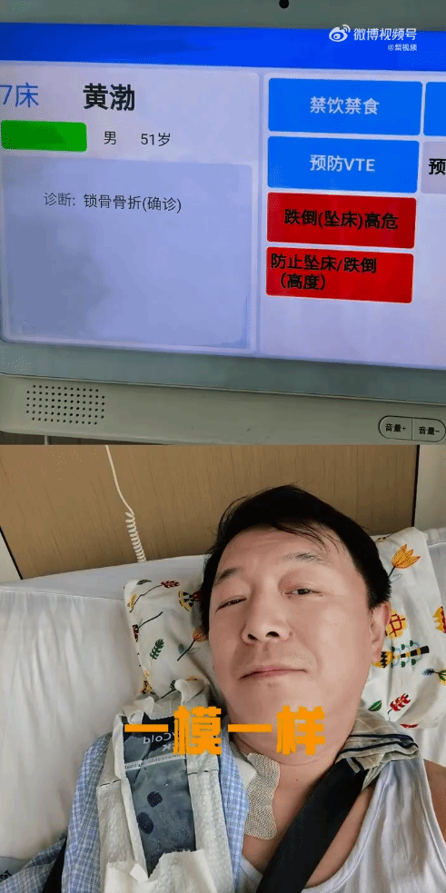 黄渤骑车摔骨折！抓住手机没抓住刹车 穷怕了舍不得扔
